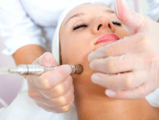 Tratamiento facial con microdermabrasión