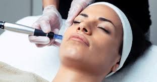 Tratamiento facial con dermapen